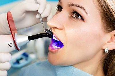 Mark Studer, DDS  | Oral Exams, Fluoride Treatment and Teeth Whitening