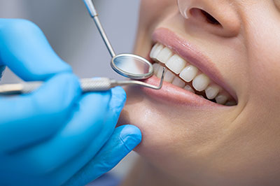 Mark Studer, DDS  | Snoring Appliances, Preventative Program and Oral Exams