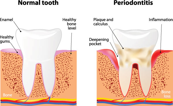 Mark Studer, DDS  | Teeth Whitening, Laser Dentistry and Dental Cleanings