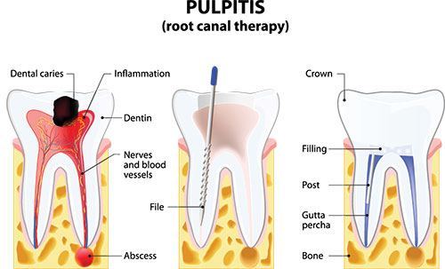 Mark Studer, DDS  | Laser Dentistry, Preventative Program and Dental Cleanings