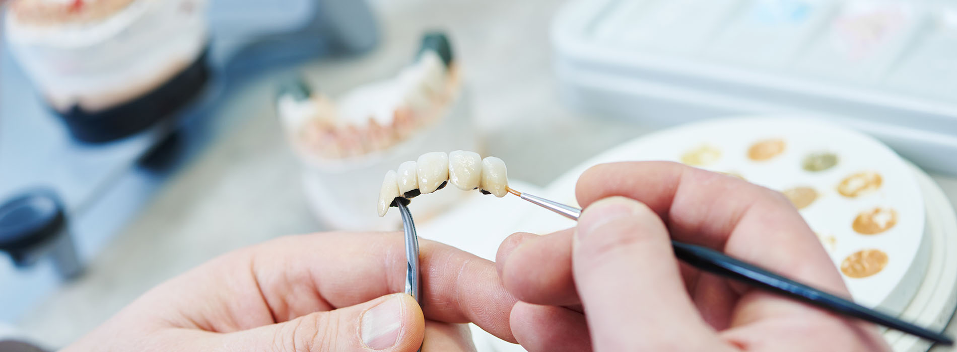 Mark Studer, DDS  | Dental Lab, Dental Cleanings and Oral Exams