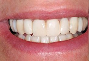Mark Studer, DDS  | Teeth Whitening, Periodontal Treatment and Dental Fillings