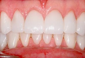 Mark Studer, DDS  | Dental Fillings, Periodontal Treatment and Sleep Apnea