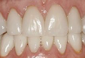 Mark Studer, DDS  | Laser Dentistry, Dental Cleanings and TMJ Disorders