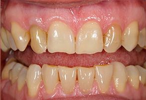 Mark Studer, DDS  | Teeth Whitening, Dental Cleanings and Laser Dentistry