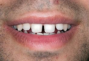 Mark Studer, DDS  | Dental Cleanings, Laser Dentistry and TMJ Disorders