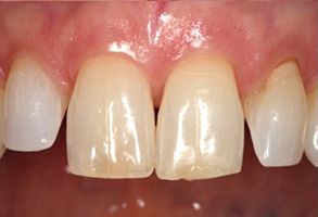 Mark Studer, DDS  | Laser Dentistry, Dental Cleanings and Sports Mouthguards