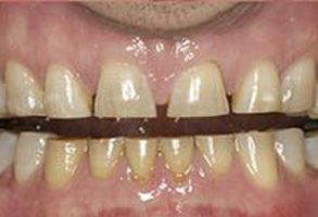 Mark Studer, DDS  | Snoring Appliances, Oral Exams and Periodontal Treatment