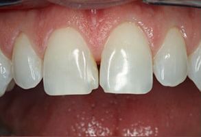 Mark Studer, DDS  | Dental Fillings, Oral Exams and Preventative Program